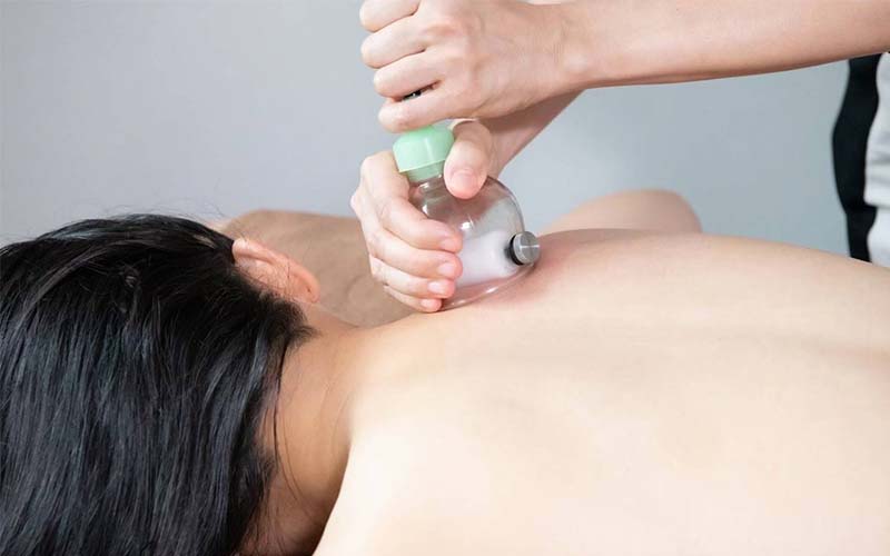 カッピングで筋膜の癒着を剥がす